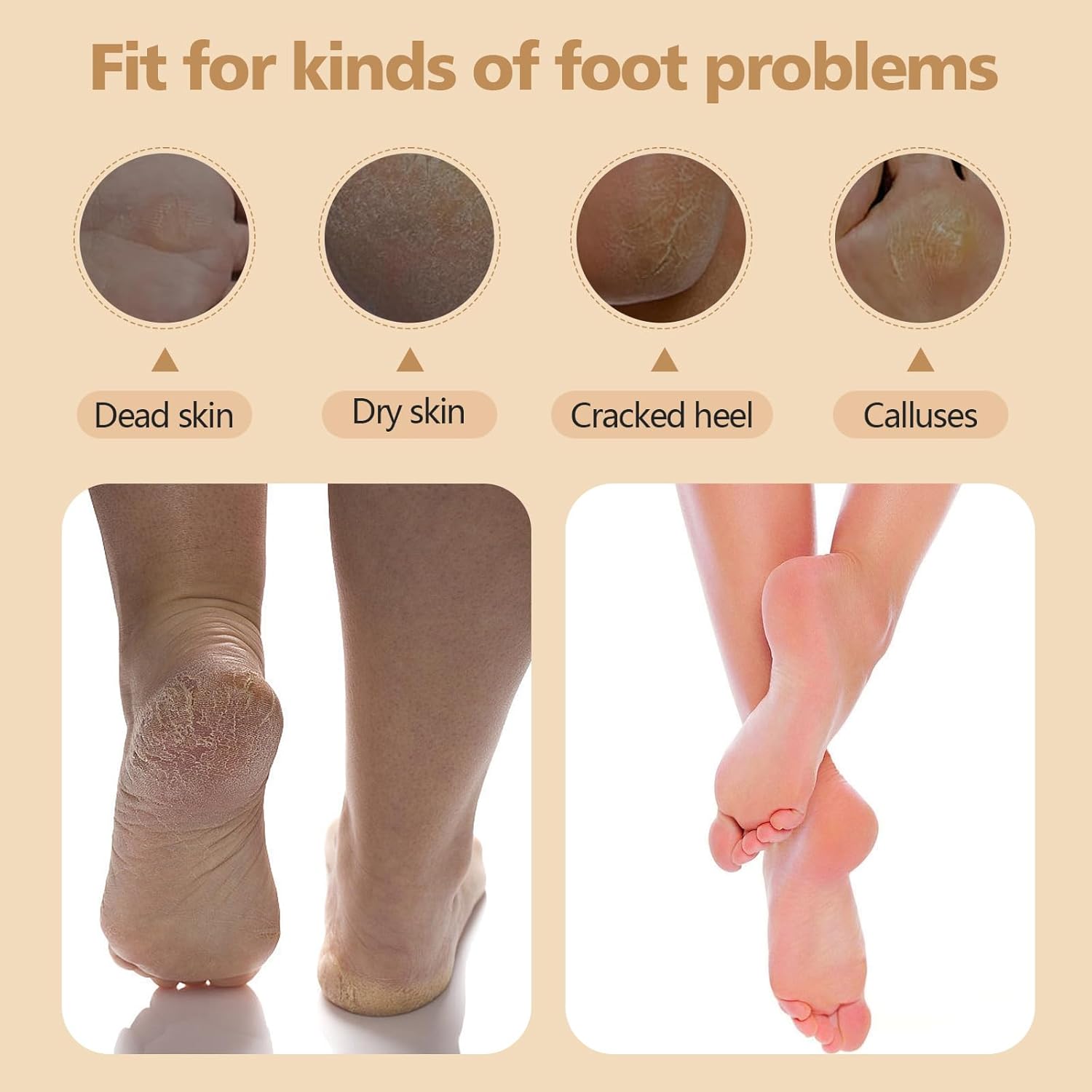 Electric Callus Removers for Feet-Pink